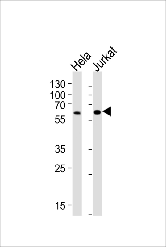 Western blot of lysates from HeLa, Jurkat cell line (from left to right), using HPSE2 Antibody. Antibody was diluted at 1:1000 at each lane. A goat anti-rabbit IgG H&L (HRP) at 1:5000 dilution was used as the secondary antibody. Lysates at 35ug per lane.