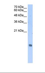 Jurkat cell lysate. Antibody concentration: 2.5 ug/ml. Gel concentration: 15%.