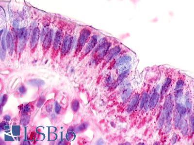 Anti-GPR20 antibody IHC of human colon. Immunohistochemistry of formalin-fixed, paraffin-embedded tissue after heat-induced antigen retrieval. Antibody LS-A101 dilution 8-21 ug/ml.
