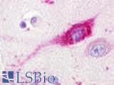 Anti-GPR20 antibody LS-A104 IHC of human brain, neuron. Immunohistochemistry of formalin-fixed, paraffin-embedded tissue after heat-induced antigen retrieval.