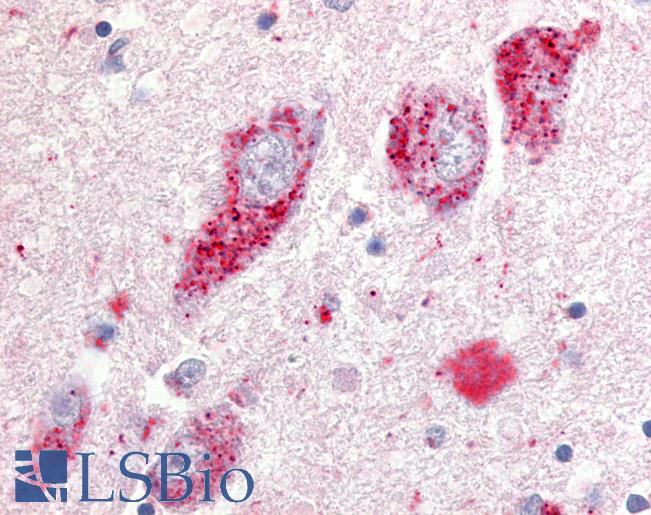 Anti-GPR20 antibody LS-A102 IHC of human basal nucleus of Meynert. Immunohistochemistry of formalin-fixed, paraffin-embedded tissue after heat-induced antigen retrieval.