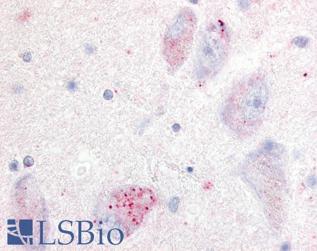 Anti-GPR20 antibody LS-A103 IHC of human basal nucleus of Meynert. Immunohistochemistry of formalin-fixed, paraffin-embedded tissue after heat-induced antigen retrieval.