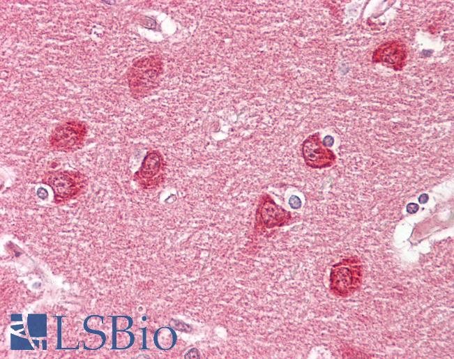 Anti-GPR20 antibody IHC of human brain, cortex. Immunohistochemistry of formalin-fixed, paraffin-embedded tissue after heat-induced antigen retrieval. Antibody LS-B7724 dilution 10 ug/ml.