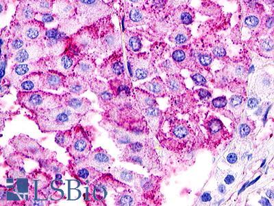 Anti-GPR21 antibody IHC of human pituitary. Immunohistochemistry of formalin-fixed, paraffin-embedded tissue after heat-induced antigen retrieval. Antibody LS-A105 dilution 1.4 ug/ml.