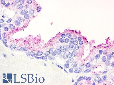Anti-GPR21 antibody IHC of human prostate. Immunohistochemistry of formalin-fixed, paraffin-embedded tissue after heat-induced antigen retrieval. Antibody LS-A105 dilution 1.4 ug/ml.