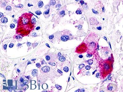 Anti-GPR21 antibody IHC of human pituitary. Immunohistochemistry of formalin-fixed, paraffin-embedded tissue after heat-induced antigen retrieval. Antibody LS-A106 dilution 1.9 ug/ml.