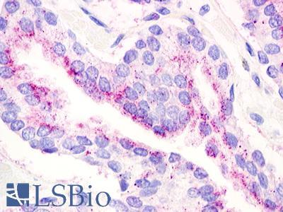 Anti-GPR21 antibody IHC of human prostate. Immunohistochemistry of formalin-fixed, paraffin-embedded tissue after heat-induced antigen retrieval. Antibody LS-A106 dilution 1.9 ug/ml.