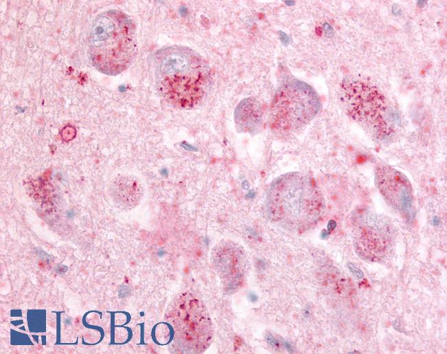 Anti-GPR21 antibody LS-A108 IHC of human brain. Immunohistochemistry of formalin-fixed, paraffin-embedded tissue after heat-induced antigen retrieval.