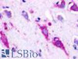 Anti-GPR22 antibody LS-A109 IHC of human brain, neurons and glia. Immunohistochemistry of formalin-fixed, paraffin-embedded tissue after heat-induced antigen retrieval.