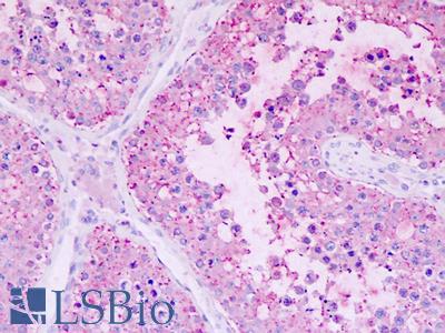 Human Testis: Formalin-Fixed, Paraffin-Embedded (FFPE)