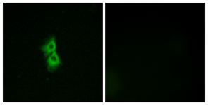 Immunofluorescence of MCF7 cells, using GPR22 Antibody. The sample on the right was incubated with synthetic peptide.