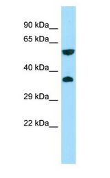 GPR22 antibody Western Blot of 293T.