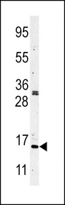 Western blot of Histone H3 in CEM cell line lysates (35 ug/lane). Histone H3(arrow) was detected using the purified antibody.