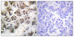 IHC of paraffin-embedded human brain, using Histone H3.3 (Ab-31) Antibody. The picture on the right is treated with the synthesized peptide.