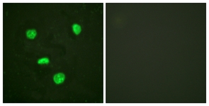 Immunofluorescence of HeLa cells, using Histone H3.3 (Ab-31) Antibody. The picture on the right is treated with the synthesized peptide.