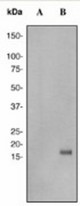 Western blot analysis on HeLa cell lysates using anti- Histone H3.3 Phospho (pS31) antibody (LS-C105605). Cells were either (A) untreated (B) treated with Calyculin.