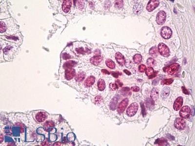 Anti-H3F3B antibody IHC of human prostate. Immunohistochemistry of formalin-fixed, paraffin-embedded tissue after heat-induced antigen retrieval. Antibody LS-B8442 dilution 15 ug/ml.