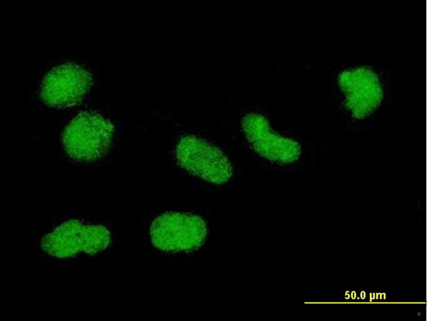 Immunofluorescence of monoclonal antibody to H3F3B on HeLa cell. [antibody concentration 10 ug/ml].
