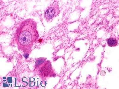 Anti-GPR25 antibody IHC of human brain, hypothalamus. Immunohistochemistry of formalin-fixed, paraffin-embedded tissue after heat-induced antigen retrieval. Antibody LS-A378 dilution 3-5 ug/ml.