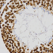 Immunohistochemistry of paraffin-embedded rat testis tissue using H4K20me3 antibody at dilution of 1:200 (x400 lens).