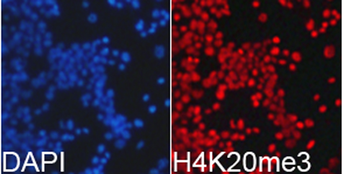 Immunofluorescence analysis of 293T cell using H4K20me3 antibody. Blue: DAPI for nuclear staining.