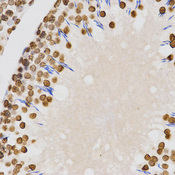 Immunohistochemistry of paraffin-embedded rat testis tissue using H4K20me2 antibody at dilution of 1:200 (x400 lens).