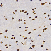 Immunohistochemistry of paraffin-embedded rat brain tissue using H4K20me2 antibody at dilution of 1:200 (x400 lens).