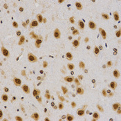 Immunohistochemistry of paraffin-embedded rat brain tissue using H4R3me2a antibody at dilution of 1:200 (x400 lens).
