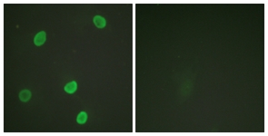 Immunofluorescence of HeLa cells, using Histone H4 (Acetyl-Lys8) Antibody. The picture on the right is treated with the synthesized peptide.