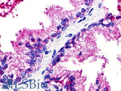 Anti-GPR25 antibody IHC of human prostate. Immunohistochemistry of formalin-fixed, paraffin-embedded tissue after heat-induced antigen retrieval. Antibody LS-A483 dilution 1-2 ug/ml.