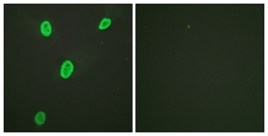 Immunofluorescence of HeLa cells, using Histone H4 (Acetyl-Lys12) Antibody. The picture on the right is treated with the synthesized peptide.
