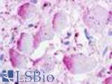 Anti-GPR26 antibody LS-A555 IHC of human brain. Immunohistochemistry of formalin-fixed, paraffin-embedded tissue after heat-induced antigen retrieval.