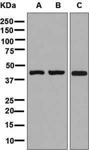 Western blot analysis on (A) fetal brain, (B) human glioma, and (C) C6 cell lysates using anti-GPR26 antibody.