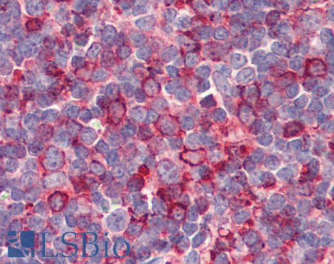 Anti-GPR26 antibody LS-A4143 IHC of human tonsil. Immunohistochemistry of formalin-fixed, paraffin-embedded tissue after heat-induced antigen retrieval.
