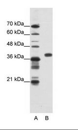 A: Marker, B: HepG2 Cell Lysate