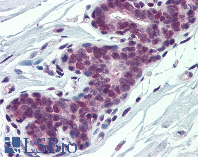 Anti-PCBP1 antibody IHC of human breast. Immunohistochemistry of formalin-fixed, paraffin-embedded tissue after heat-induced antigen retrieval. Antibody LS-B3984 concentration 5 ug/ml.