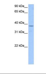 HepG2 cell lysate. Antibody concentration: 1.0 ug/ml. Gel concentration: 12%.