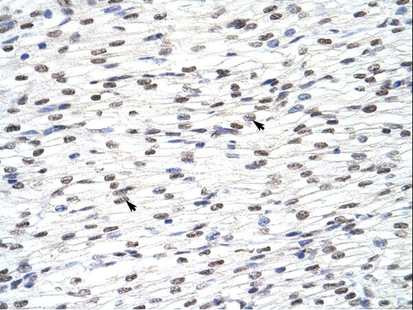 HNRPLL antibody LS-C31255 was used in IHC to stain formalin-fixed, paraffin-embedded human heart.