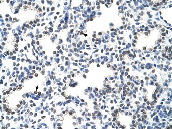 HNRPLL antibody LS-C31255 was used in IHC to stain formalin-fixed, paraffin-embedded human lung.