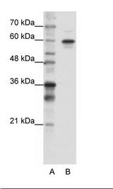 A: Marker, B: HepG2 Cell Lysate