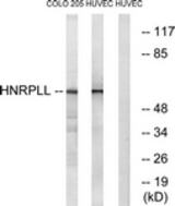 Western blot of extracts from HUVEC/COLO cells, using HNRPLL Antibody. The lane on the right is treated with the synthesized peptide.