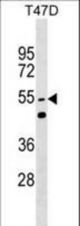 HNRPLL Antibody western blot of T47D cell line lysates (35 ug/lane). The HNRPLL antibody detected the HNRPLL protein (arrow).