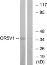 Western blot of extracts from RAW264.7 cells, using OR5V1 Antibody. The lane on the right is treated with the synthesized peptide.