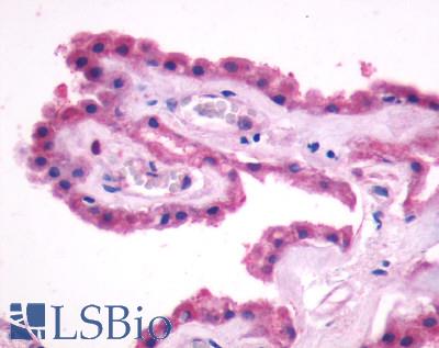 Anti-GPR27 antibody LS-A496 IHC of human brain, choroid plexus. Immunohistochemistry of formalin-fixed, paraffin-embedded tissue after heat-induced antigen retrieval.