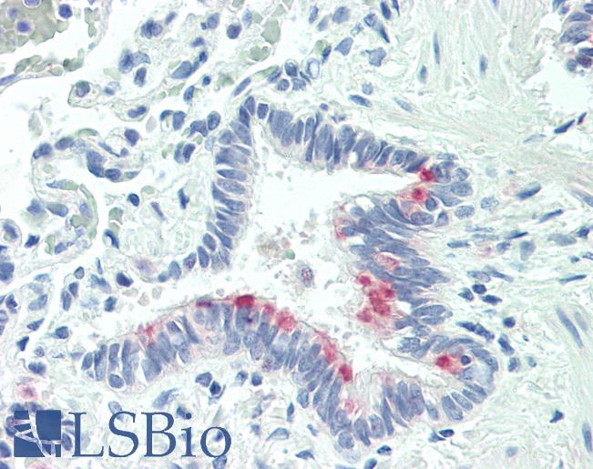 Anti-HsT19268 / MTHFS antibody IHC staining of human lung. Immunohistochemistry of formalin-fixed, paraffin-embedded tissue after heat-induced antigen retrieval. Antibody LS-B10296 concentration 5 ug/ml.