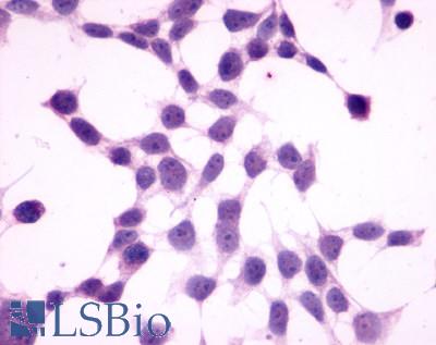 Anti-GPR27 antibody LS-A496 immunocytochemistry (ICC) staining of untransfected HEK293 human embryonic kidney cells.