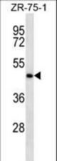 IGHE Antibody western blot of ZR-75-1 cell line lysates (35 ug/lane). The IGHE antibody detected the IGHE protein (arrow).