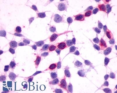 Anti-GPR27 antibody LS-A496 immunocytochemistry (ICC) staining of HEK293 human embryonic kidney cells transfected with GPR27.