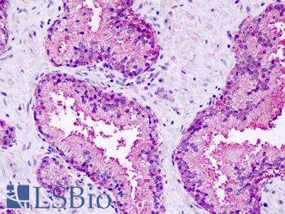 Human, Prostate: Formalin-Fixed Paraffin-Embedded (FFPE)