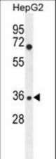 IGHG1 Antibody western blot of HepG2 cell line lysates (35 ug/lane). The IGHG1 antibody detected the IGHG1 protein (arrow).